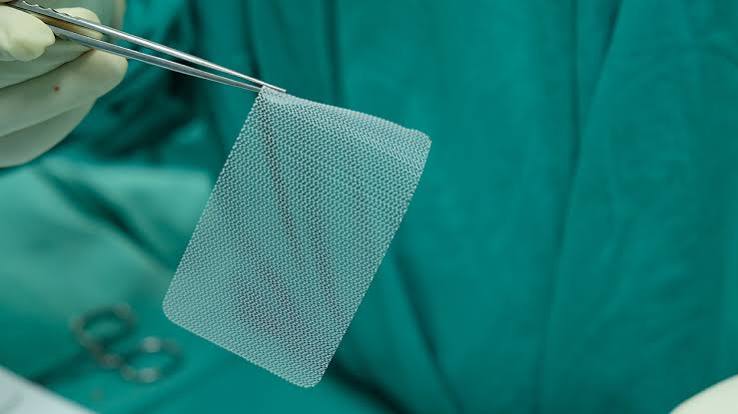 Hernia Mesh Lawsuit