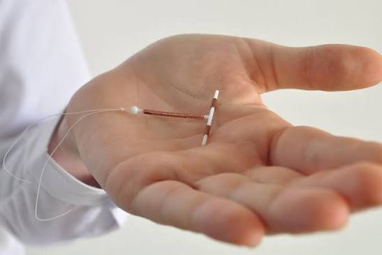 Paragard IUD Lawsuit